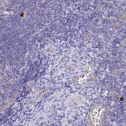 ARP10 Antibody, Novus Biologicals 0.1mL; Unlabeled:Antibodies, Polyclonal